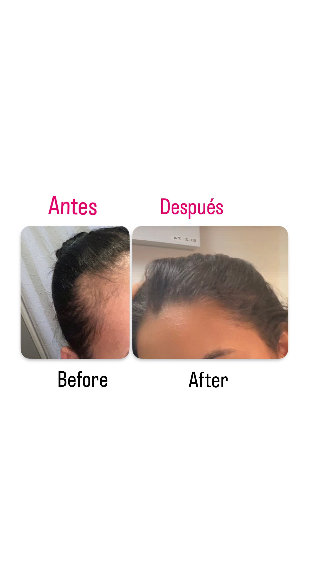 Gotero anti- caída y crecimiento / Anti-Hair Loss Dropper